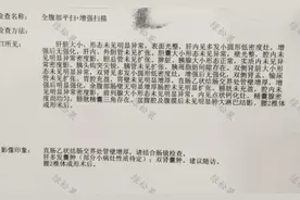 大便不成形查出结肠癌，69岁患者手术治疗全经验图片