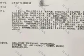 大便不成形查出结肠癌，69岁患者手术治疗全经验图片