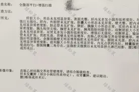 大便不成形查出结肠癌，69岁患者手术治疗全经验图片