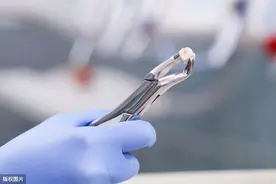 拔牙肿痛一般不超三天图片