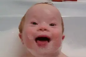 唐氏儿宝宝面部是什么样子？想生个健康宝宝，孕期3个产检不能省图片