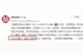 啤酒瓶、黄鳝、木瓜……直肠异物为什么进去容易出来难？图片