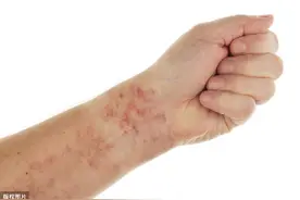 血小板低能通过输血来补吗？图片
