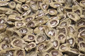 男子“有口难开”进食困难，因他一年前开始嚼槟榔图片