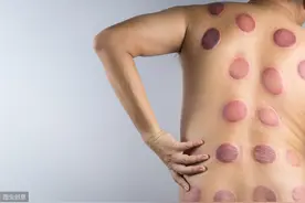 拔罐后的皮肤颜色，代表着什么健康问题？中医给出了八种解释图片