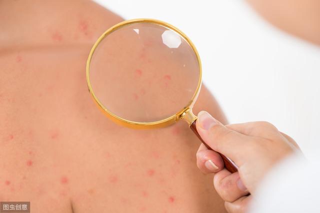 手臂上鸡皮肤解决方法