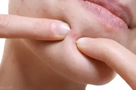 身体不同部位“小疙瘩”，预示不同疾病！符合 7 点是恶性信号图片