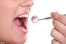 口腔不明出血警惕口腔癌图片