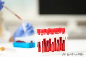 当血尿酸过高合并阳痿，治疗有何讲究？能吃他达拉非吗？一文说清图片