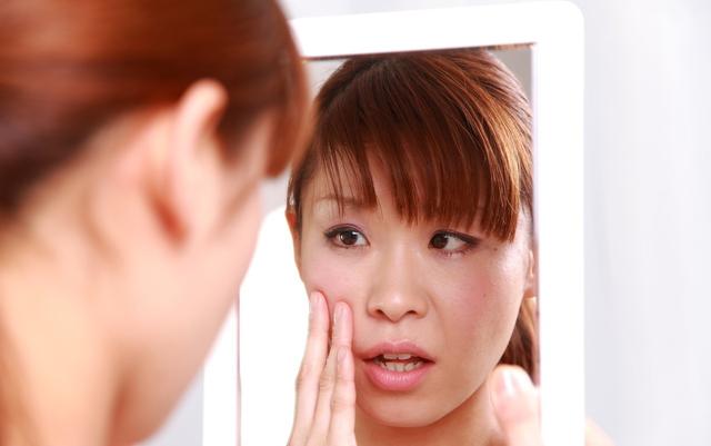 阿达帕林凝胶可以治面部鸡皮肤吗