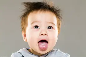 “地图舌”是怎么回事？图片