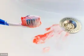 口臭、牙龈红肿渗血可能不是上火，而是得了牙周病，教你正确疗法图片