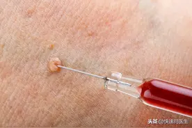 皮肤上凸起的小疙瘩是什么？别大意，可能是这四种情况图片