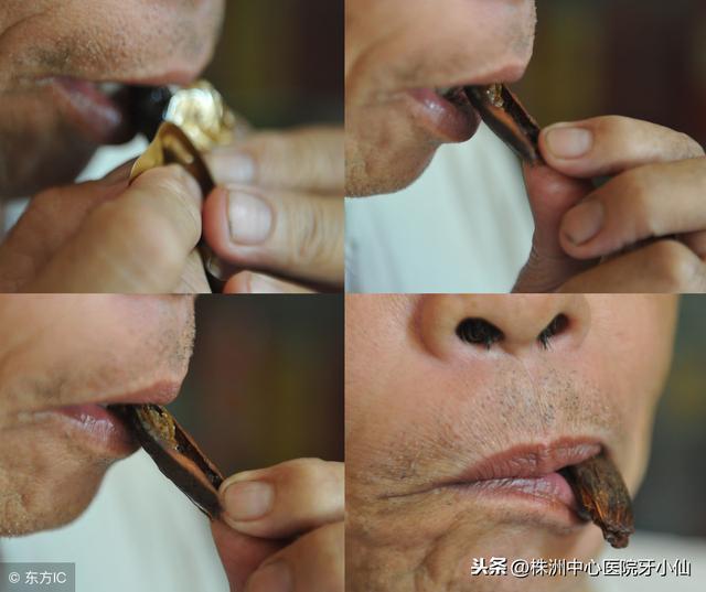 口腔粘膜角化是什么病