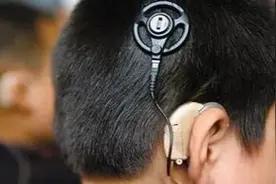 人工耳蜗纳入广西医保，更多患者有望把耳朵叫醒！图片