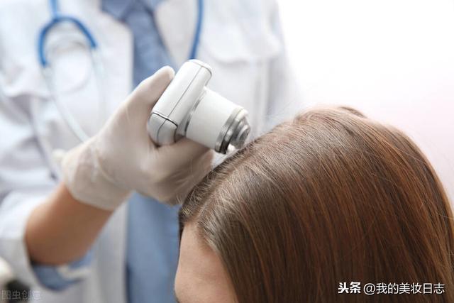 硫磺皂洗头发有什么功效？秃头女孩的福利来了，请查收