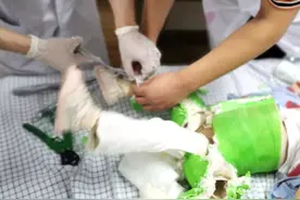 揪心！两腿“装在绿套子”里的先髋宝宝，可爱背后却暗藏忧伤图片