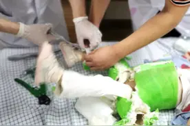 揪心！两腿“装在绿套子”里的先髋宝宝，可爱背后却暗藏忧伤图片