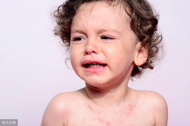 8岁女孩脸部有毛囊角化丘疹