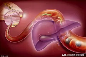疟疾新药青蒿琥酯，获美国批准图片