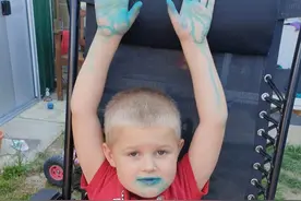 英国男孩吃冰棍后手上嘴巴全变蓝色，厂家说没事补偿他一包糖果图片