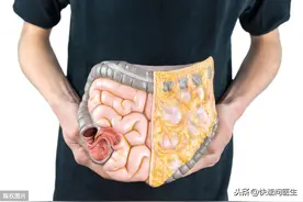 排便时，大便刚开始是硬的，后来是稀的，是什么问题？图片