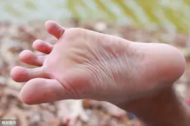 为什么有的人会有脚臭？脚臭就是有脚气吗？图片