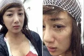 2014年李依晓被狗咬致“毁容”后缝20多针，6年了，她现状如何？图片