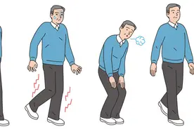 血管科医生告诉你，脚麻、冷、痛可能与这些疾病有关图片