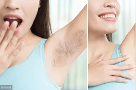 夏天来了，可女性毛发太旺盛怎么办？三个脱毛方法，你选对了吗？图片