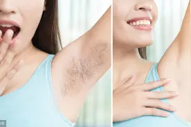夏天来了，可女性毛发太旺盛怎么办？三个脱毛方法，你选对了吗？图片