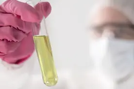 糖尿病出现尿蛋白，就离尿毒症不远了？不必担心，2种药助你护肾图片