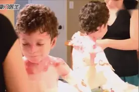 全世界最痛苦的罕见疾病