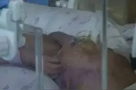 爱心追踪：贵州重症双胞胎妹妹今天还好吗？微兔公益图片
