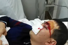 病人家属拳击医生致左眼鲜血直流 因遭拒使用他人医保卡图片