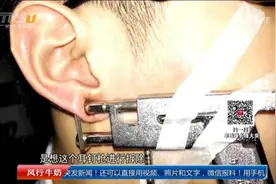 男子赶时髦打耳洞 耳钉枪失灵卡耳垂