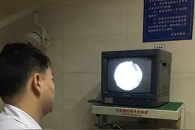 男子鼻腔藏蚂蝗 几经波折终取出图片