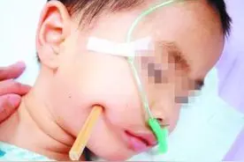 两岁男童摔倒筷子插入脑袋 熊孩子吃饭看动画片酿悲剧图片