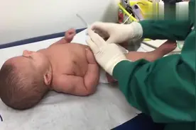 2个月大的宝宝体检注射疫苗，哭得满脸通红的样子太让人心疼了视频封面