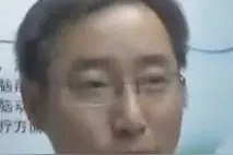 脑袋切开后，病人还被“术中唤醒”和医生聊天，竟是因为……图片