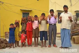 印度一特殊的家族：孩子天生有12根手指12根脚趾！图片