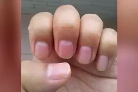 指甲上没月牙是病吗？吃一种食物7天长出月牙
