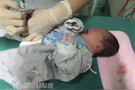 胎儿脐带绕颈，第113医院妇产科合力抢救高危母子图片