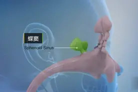 鼻窦炎如何手术治疗？3D动画演示鼻内窥镜下微创手术视频封面