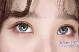 戴美瞳究竟是变美了，还是害了你自己！一看便知视频封面