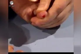 解读：血型鉴定的方法