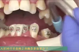 你知道人一辈子为什么只能长两次牙吗？今天算是弄明白了