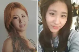 张碧晨被爆整容 张碧晨整容前后对比照图片