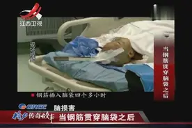 钢筋顺利从脑中取出，男孩意识模糊，奇迹却次次发生视频封面