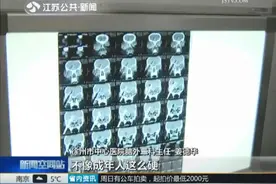 1岁女童螺丝刀插入大脑 医生提醒：提高警惕 莫让异物成凶手图片
